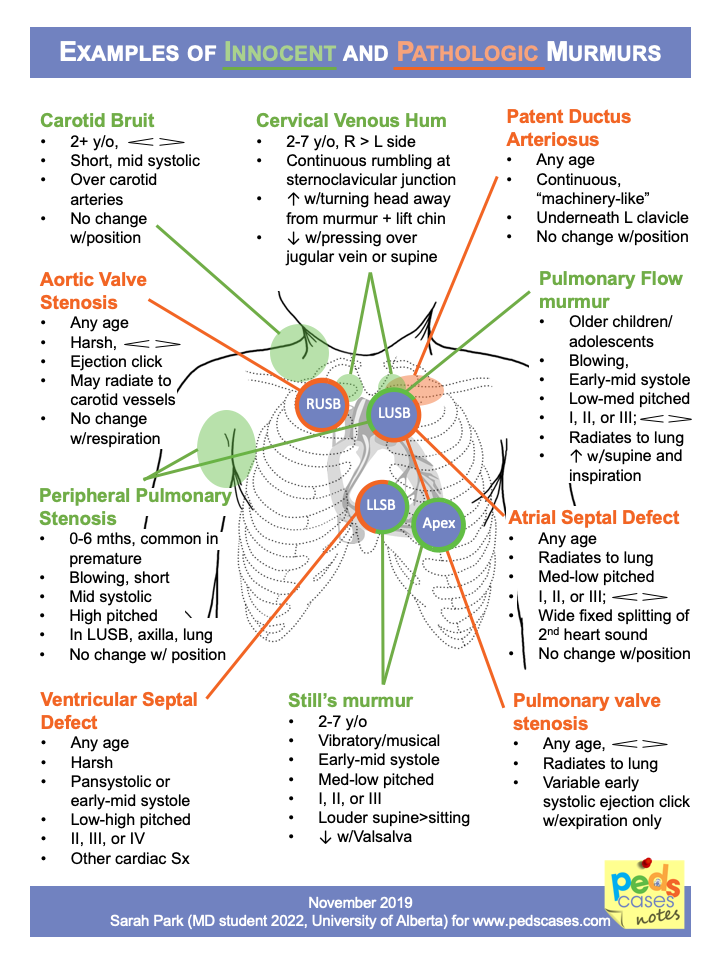 Chart Of Heart Murmurs